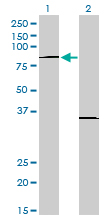 WB - PRDM1 Antibody (monoclonal) (M01) AT3417a